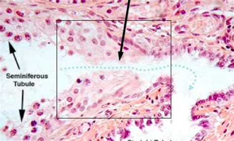 12 Endo Repro Histology Genital System Male II Flashcards Quizlet