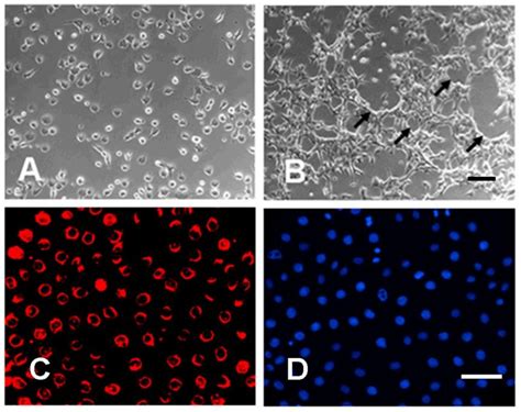 Figure From Protein Kinase C And C Abl Kinase Are Required For