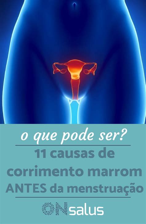 Notou Corrimento Marrom Veja O Que Pode Ser E O Que Fazer Dicas De My