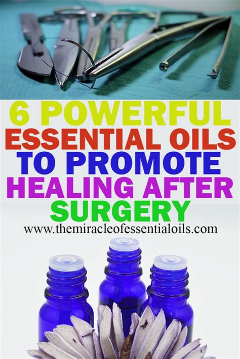 6 Best Essential Oils To Promote Healing After Surgery The Miracle Of