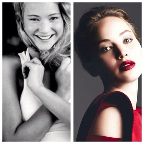 Jennifer Lawrence nose job before & after | Nose job, Beauty hacks, Beauty