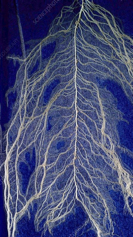 Plant roots with root nodules - Stock Image - C059/9749 - Science Photo ...