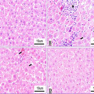 Photomicrographs H E Scale Bar M Of Male Wistar Rat Liver