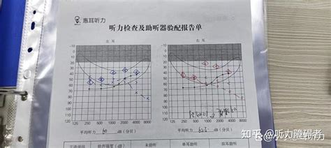 重庆渝北加州惠耳听力助听器：高龄老人为何选配助听器？ 知乎