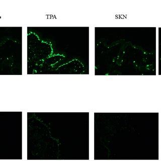 Ki 67 And TUNEL Staining Of Skin Epidermal Tissues At The End Of The