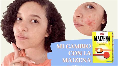 2 Mascarillas MÁgicas De Maizena Para Tener La Piel Perfecta Bonita Y