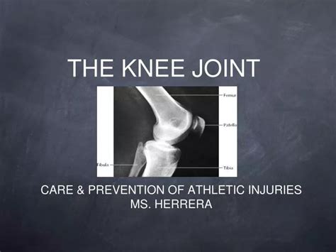 Ppt The Knee Joint Powerpoint Presentation Free Download Id5749472