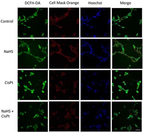 IJMS Free Full Text Effects Of Nutraceuticals On Cisplatin Induced