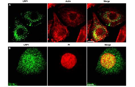 Subcellular Distribution Of LRP1 In HCS 2 8 Cells HCS 2 8 Cells Were