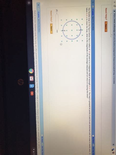 Solved The Flexible Loop In The Figure Below Has A Radius Of Chegg