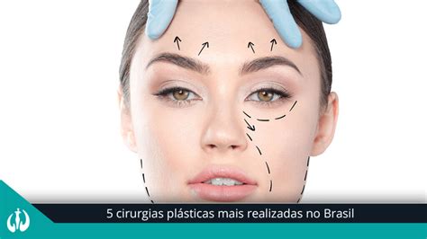 5 Cirurgias Plásticas Mais Realizadas No Brasil Cirurgia Plástica Bh