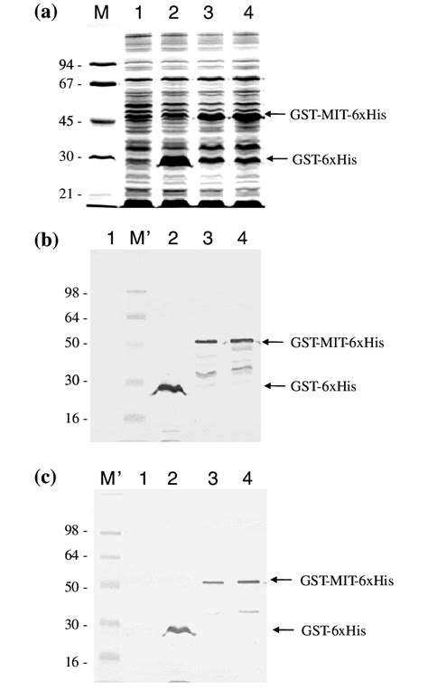 Resolution Of Whole Cell Proteins From Parent E Coli Bl Lane