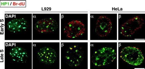 Domains Rich In Hp And Can Be Found At Late Replicating Foci