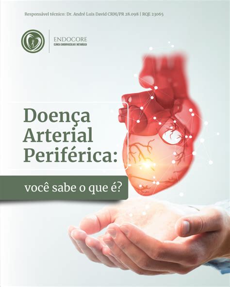 Doen A Arterial Perif Rica Voc Sabe O Que Endocore