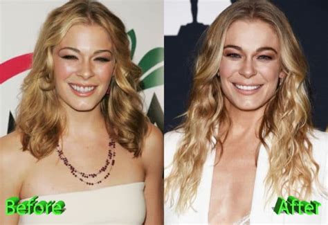 Leann Rimes Plastic Surgery A New Look For The Hubby