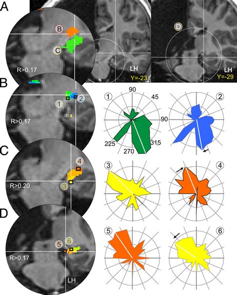 Retinotopic Maps In AH S LGN A Two Coronal Sections Through The