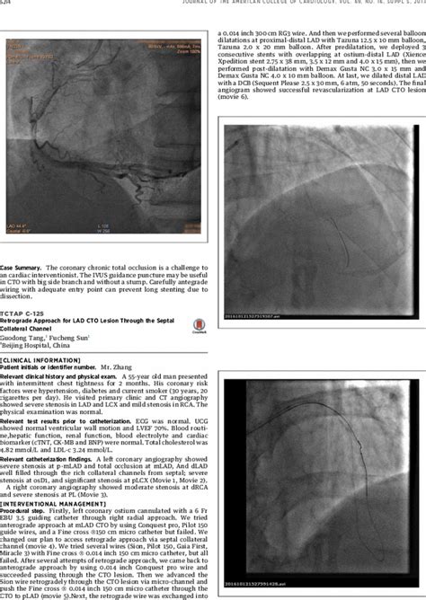 Tctap C Retrograde Approach For Lad Cto Lesion Through The Septal