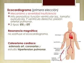 Valvulopat A Mitral Y Tric Spide Ppt