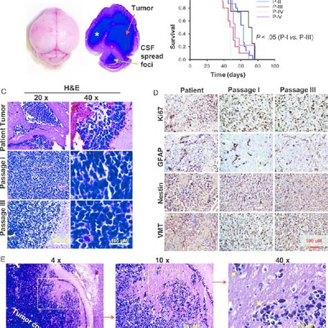 Histopathological Characteristics Of The Orthotopic Xenograft Mouse