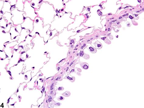 Lung Epithelium Degeneration Nonneoplastic Lesion Atlas