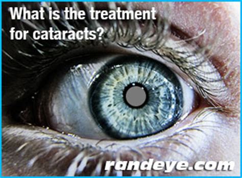 What is the treatment for cataracts? | Rand Eye Institute