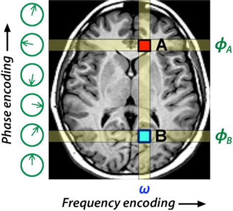 Single Pe Step Questions And Answers In Mri