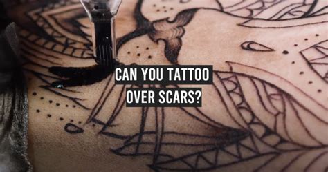 Can You Tattoo Over Scars Tattooprofy