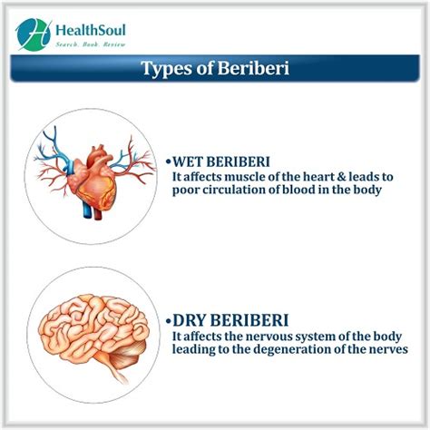 Beriberi Overview Symptoms Causes Diagnosis And Management Healthsoul