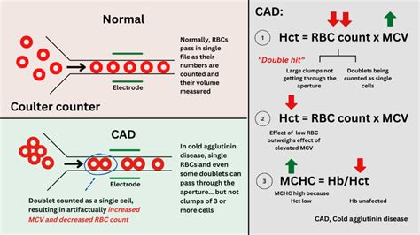 Cbc Changes In Cold Agglutinin Disease The Blood Project