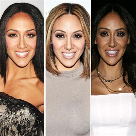 Melissa Gorga Plastic Surgery Experts Predict More Than A Nose Job