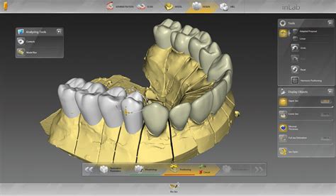 Inlab Software Dental Cad Software Dentsply Sirona Hong Kong