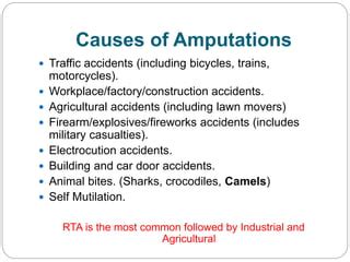 Traumatic amputations | PPT