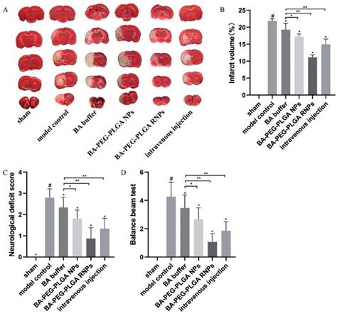 The Neuroprotective Effect Of Ba On Mcao Rats In Terms Of Cerebral