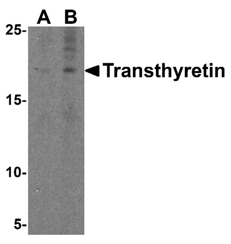 Polyclonal Ttr Antibody MyBioSource