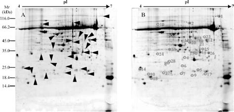 Representative Two Dimensional Electrophoresis 2 De Gels Of Proteins