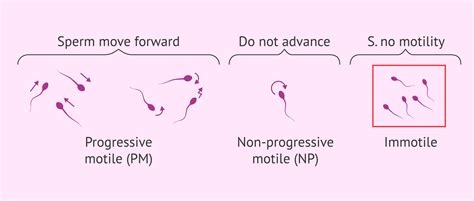 What Values Are Normal In Sperm Motility Analysis