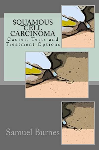 Squamous Cell Carcinoma: Causes, Tests and Treatment Options by Burnes ...