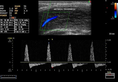 Ecocolordoppler Venoso E Arterioso Arti Inferiori Costo Suggerimenti