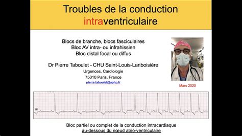 4b Les Blocs Intraventriculaires Bloc De Branche BAV Dr Taboulet