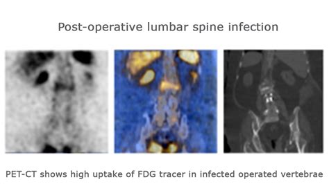 Evaluation Of Multimodality Imaging In The Diagnosis And Assessment Of