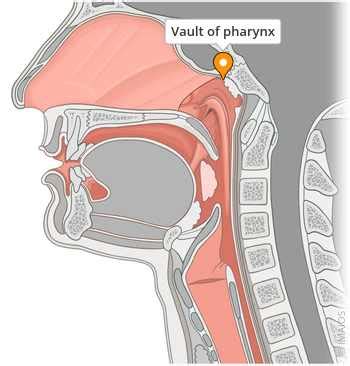 Vault of pharynx - e-Anatomy - IMAIOS