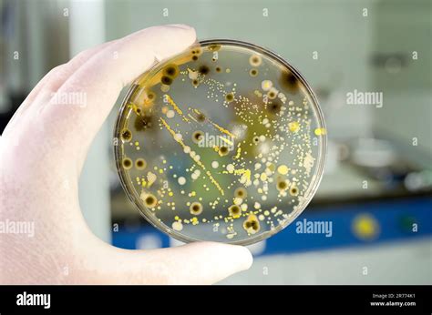 Colonies Of Different Bacteria And Mold Fungi Grown On Petri Dish With