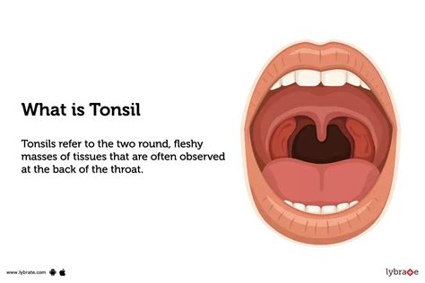 Tonsils/Tonsillitis: Causes, Symptoms, Diagnosis and Treatment