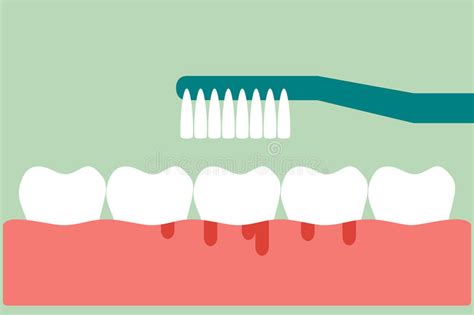 Brushing Teeth with Bleeding on Gum and Tooth Concept Gingivitis or ...