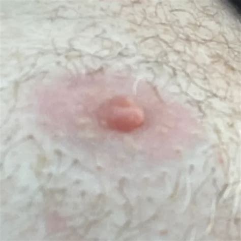 Annemarie Free Shemale British Trans Man Porn Video XHamster