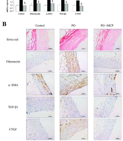 Pharmacological Inhibition Of Gal 3 Prevents Vascular Fibrosis