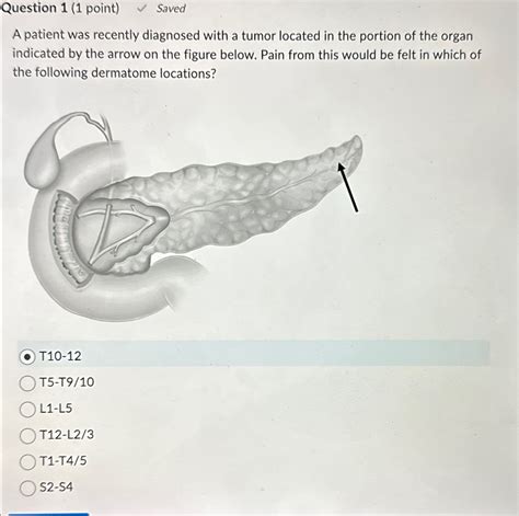 Solved Question Point Saveda Patient Was Recently Chegg