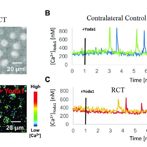 PIEZO1 Functional Expression 14 Weeks Status Post RCT A