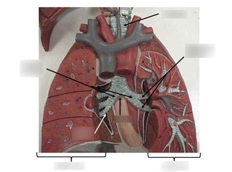 Lower Respiratory Tract Diagram Quizlet