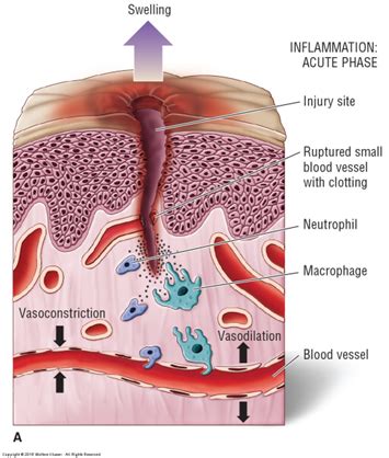 Inflammatory Process Diagram | Quizlet 